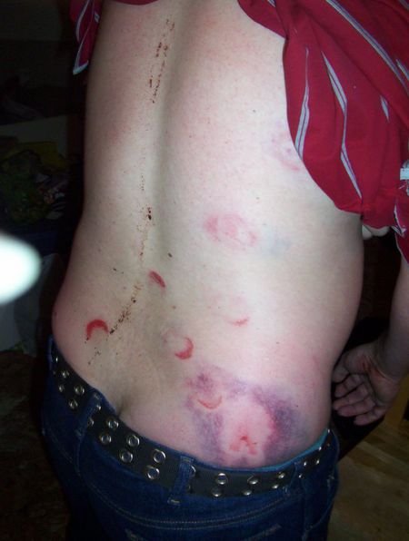 Beating described as "attempted murder" by victims