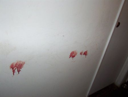 Calgary Home Invasion & Beating is Suspected Neo-Nazi Retribution