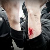 G20 Resistance Photo Round-up