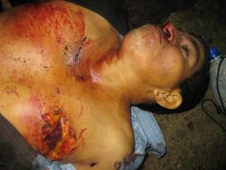 Photos of November 15 2010 massacre in Tumbador, Trujillo, Honduras